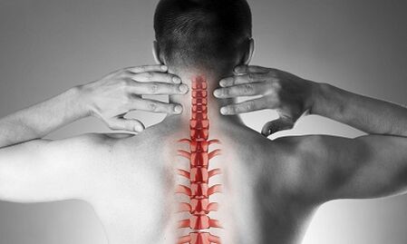 Kaip gimdos kaklelio stuburo osteochondrozė pasireiškia