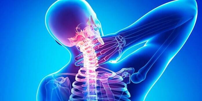 gimdos kaklelio osteochondrozė
