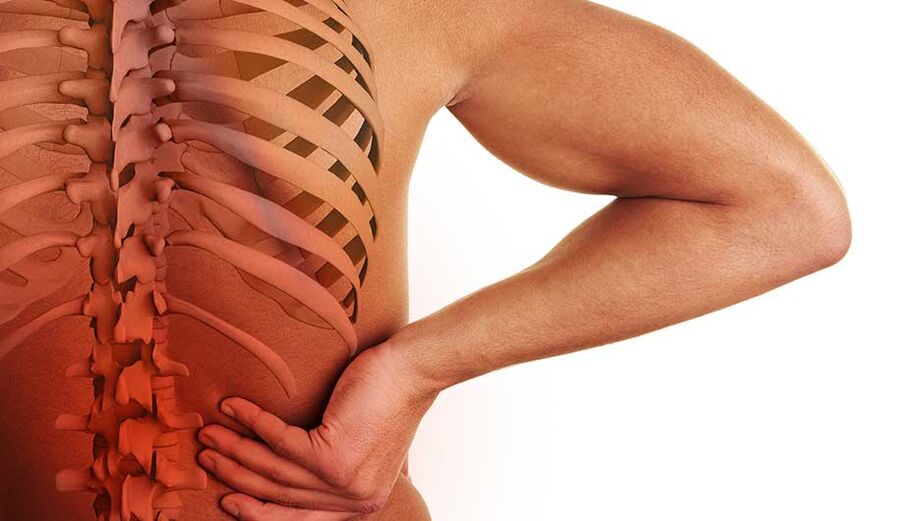 Juosmens stuburo osteochondrozė