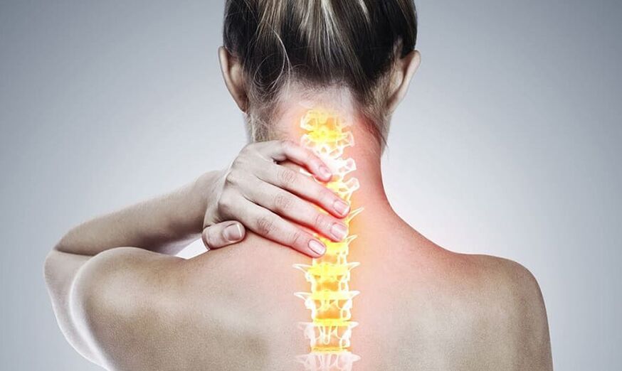 Gimdos kaklelio stuburo osteochondrozė